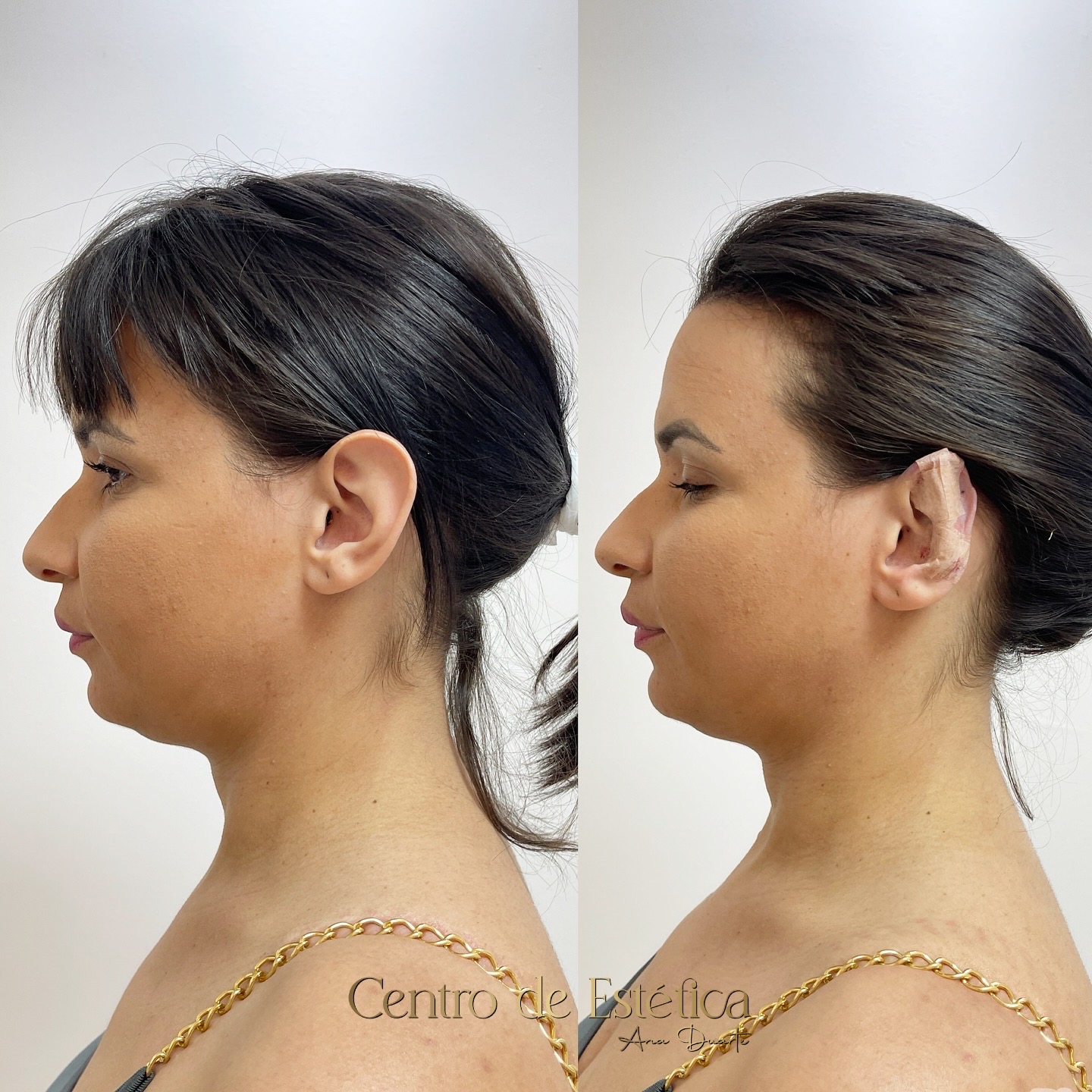 AAE2F365-0385-42EF-AA35-503EB1BF1E13